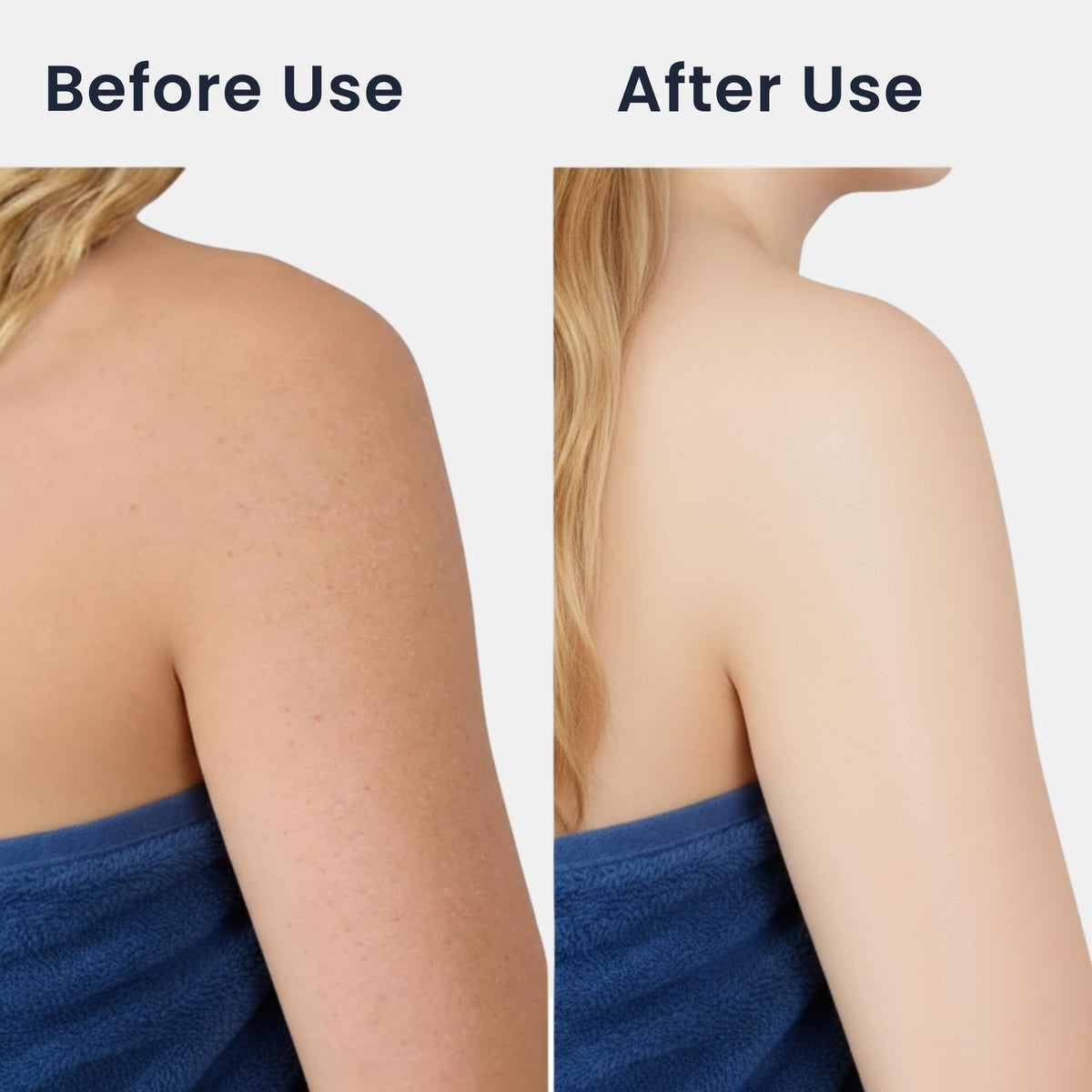 Vertaze back scrubber showing hex pattern for dual exfoliation of oil and dead skin.