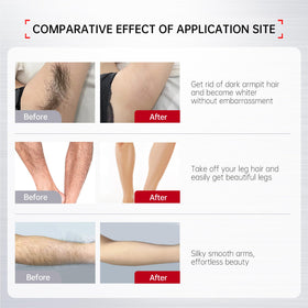 VGO cream applied to leg area for quick, comfortable removal.