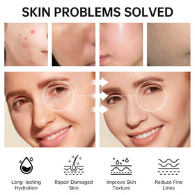 VGO Skin Care Set toner bottle delivers hydrating balance for refreshed skin