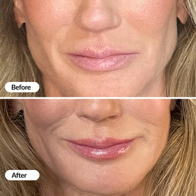 Vibriance Lip Volumizer hyaluronic-acid formula highlights skin-friendly hydration and gentle care.
