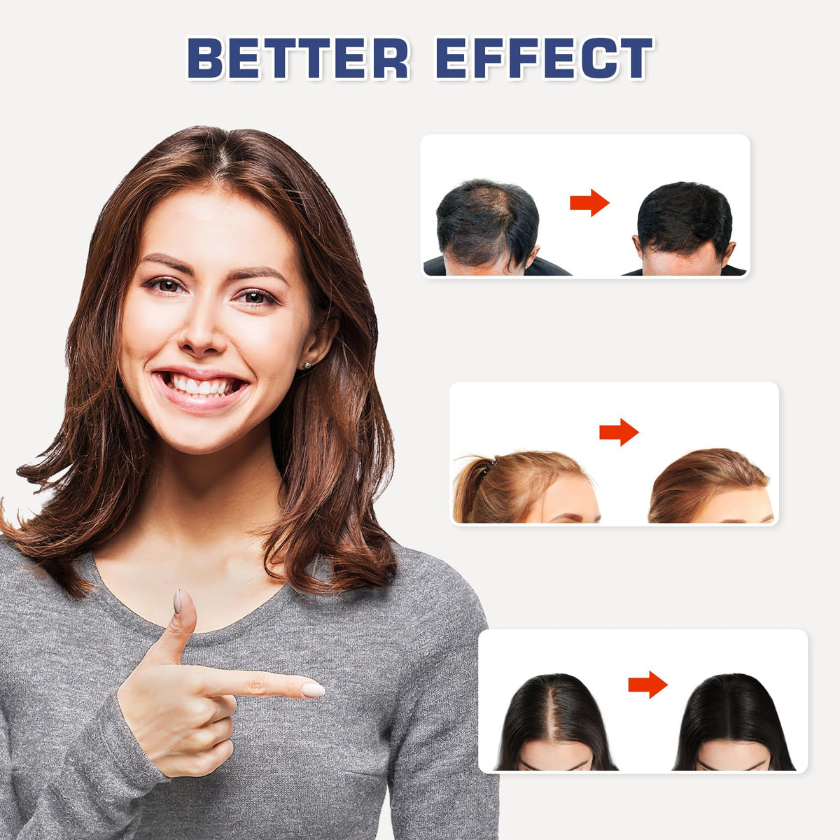 Viconor Laser Cap on head showing comfortable scalp coverage for even light delivery.