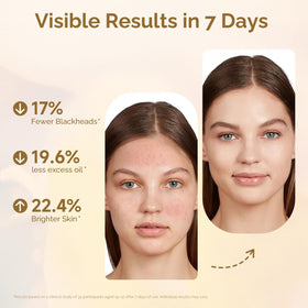 VICTORIA soap bar close-up reveals egg white texture for smoother skin.
