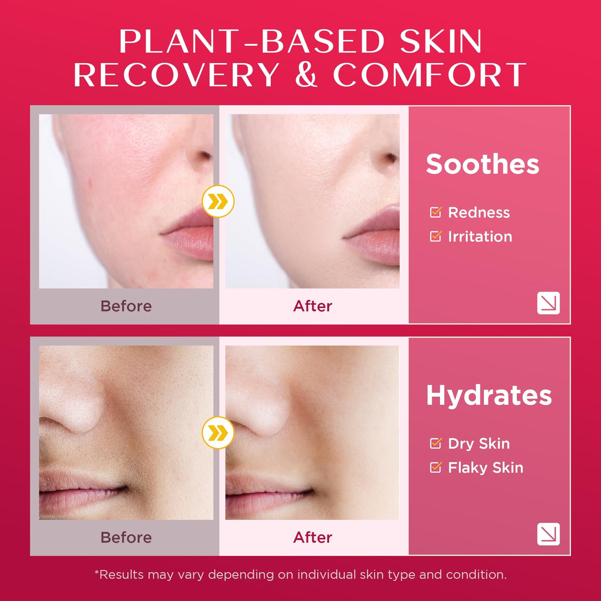 Vigority Calendula Cream applied to elbows offers soothing nourishment for dry skin