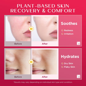 Vigority Calendula Cream applied to elbows offers soothing nourishment for dry skin