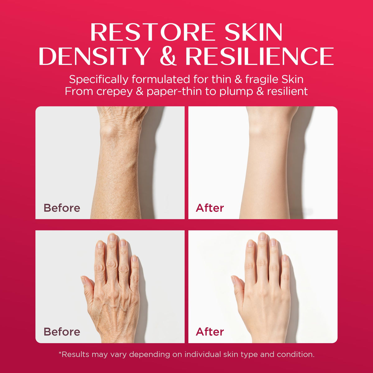 Vigority Calendula Cream on the face demonstrates daily moisturization for fine lines