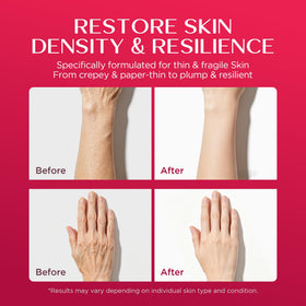 Vigority Calendula Cream on the face demonstrates daily moisturization for fine lines