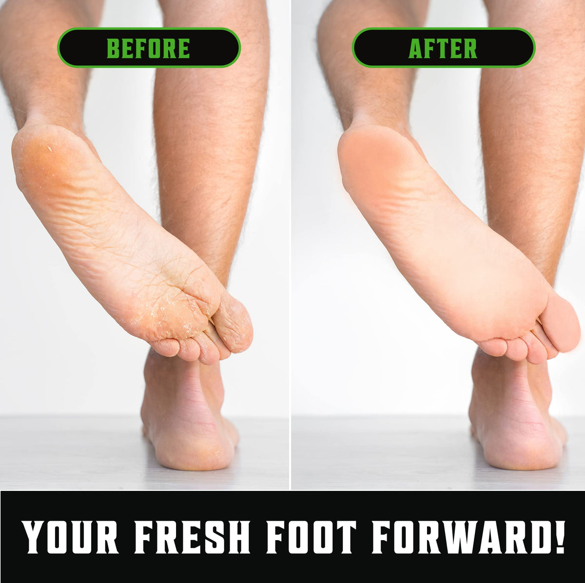 Viking Revolution Tea Tree Foot Care supports everyday comfort