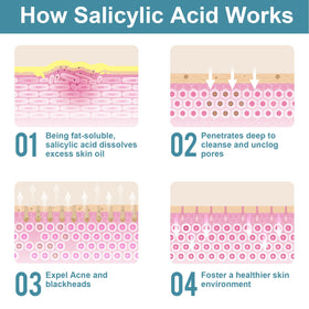 Viktairy salicylic acid powder as a toner ingredient to refine texture and tone