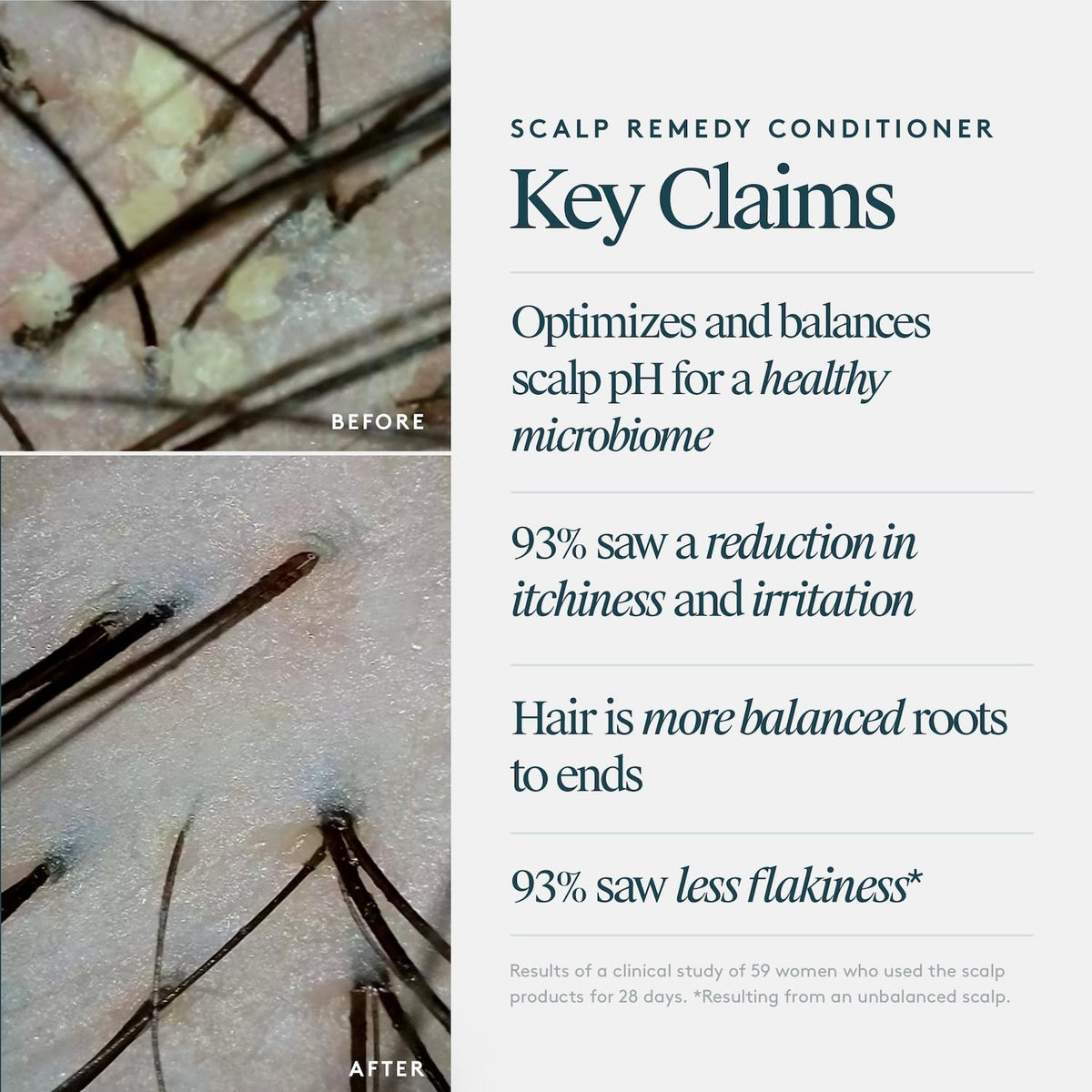 VIRTUE Scalp Remedy cream texture closeup reveals lightweight daily conditioning.