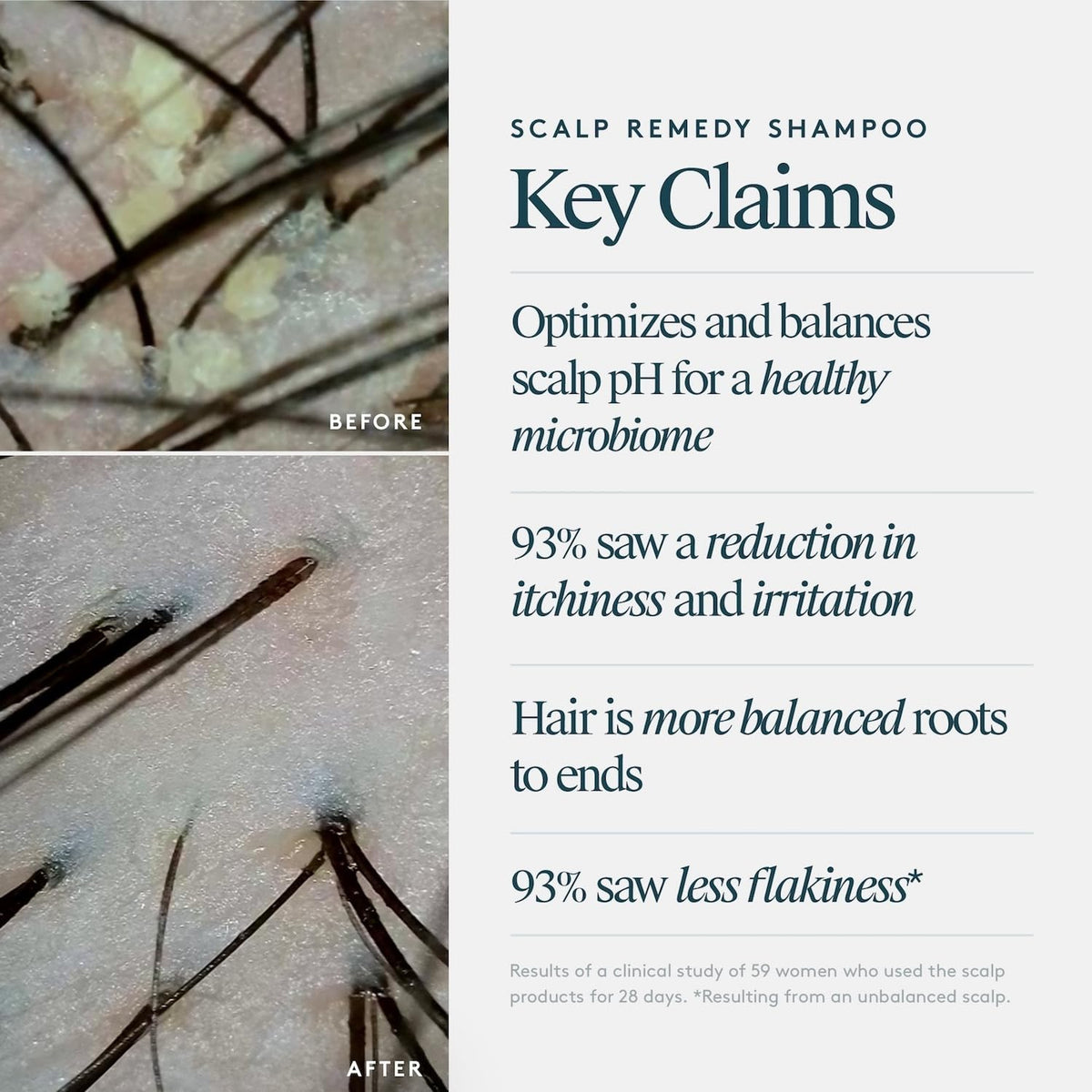 VIRTUE Scalp Remedy Shampoo pour demonstrates easy, controlled application.