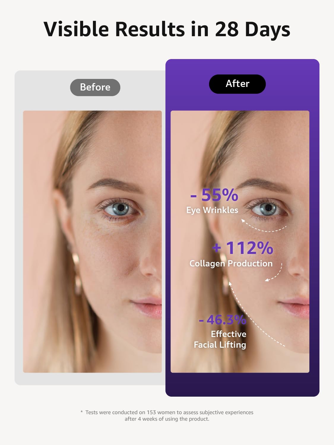 VITALY Glow Pro device wrinkle-reduction helps smoother skin and refined texture.