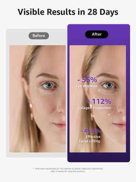 VITALY Glow Pro device wrinkle-reduction helps smoother skin and refined texture.