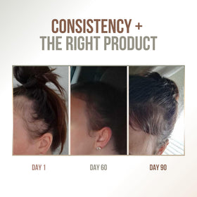 Vitamo Batana Oil bottle with dropper for precise scalp care.