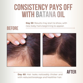 Vitamo Batana Oil being applied to hair to combat dryness.