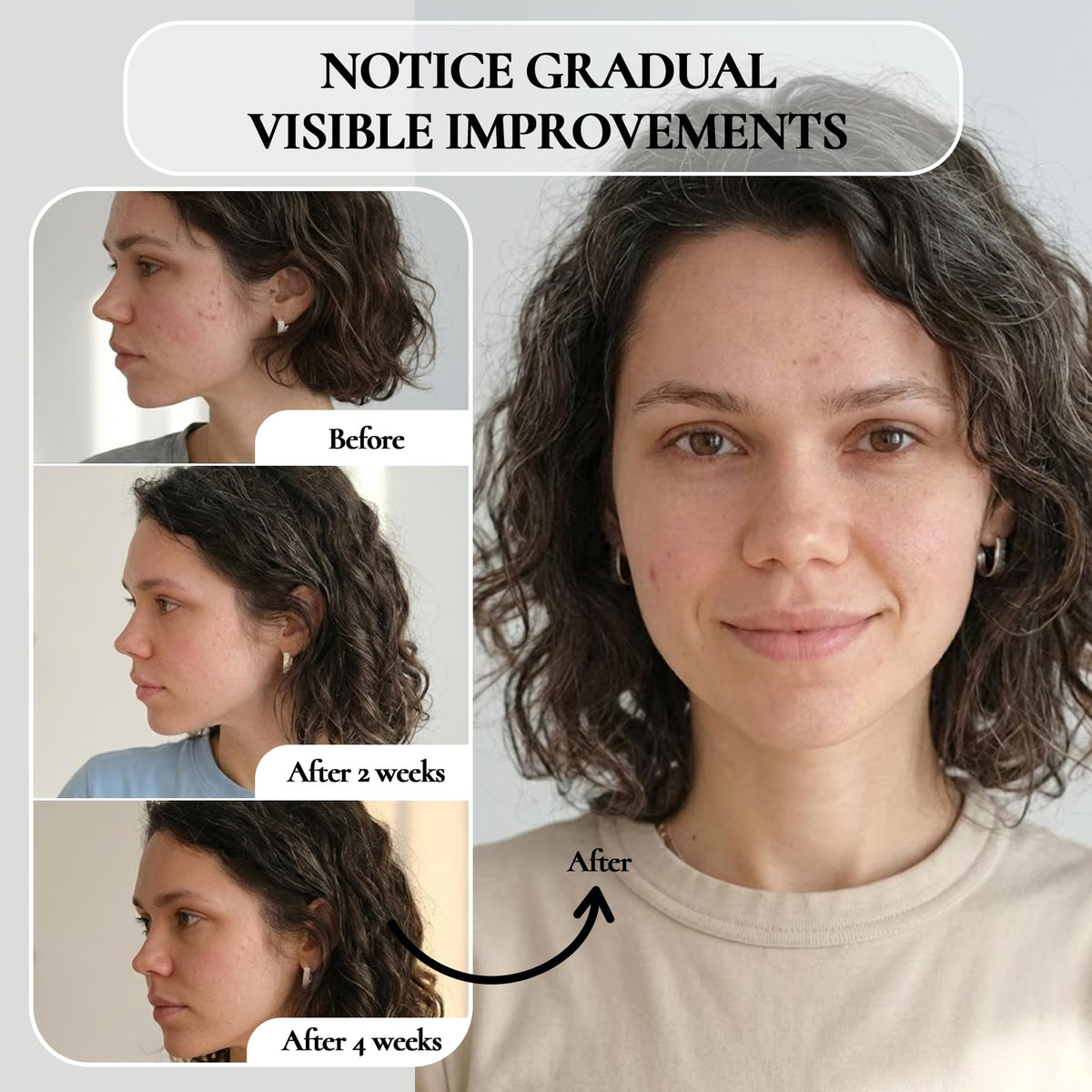 Vivo Per Lei applied to nose and T zone addressing surface buildup