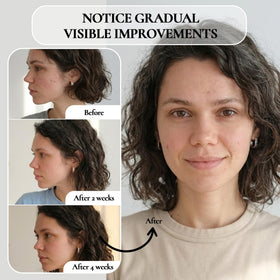 Vivo Per Lei applied to nose and T zone addressing surface buildup