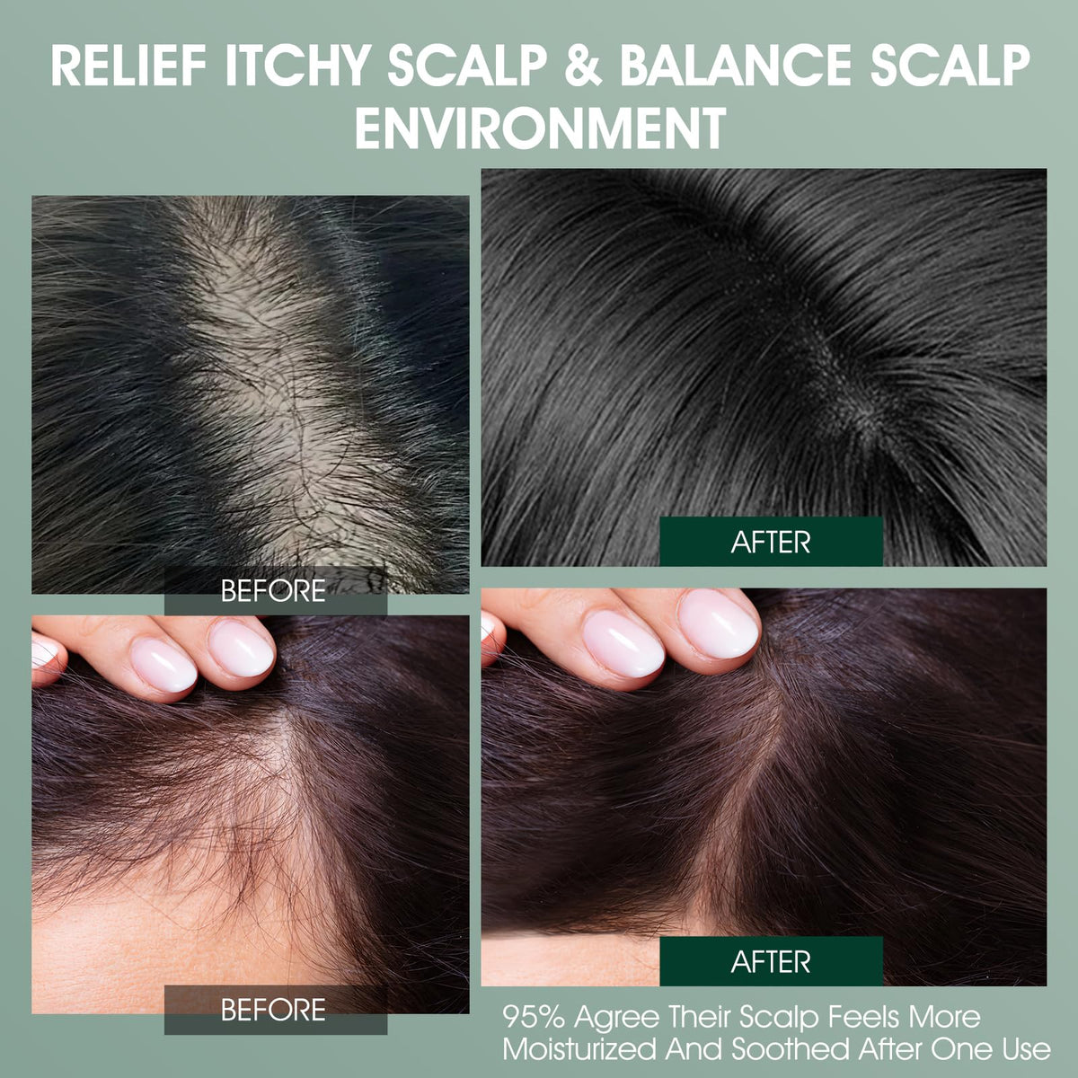 VOERUY Rosemary Tea Tree color-safe hair with scalp-friendly care.