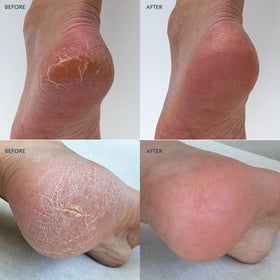 VOESH at-home foot care routine for everyday hydration