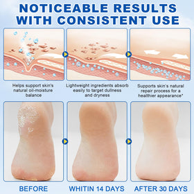 Vortexonix glide-on stick smoothing dry skin after use on feet.