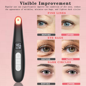 Vowleike Eye Lift Wand temperature range enables customized treatment warmth