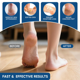 VREKEF Urea Cream 40% duo-pack display for home foot care.