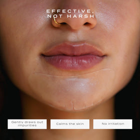 Vue Chin Patches are suitable for all skin types with a soft, comfortable feel.