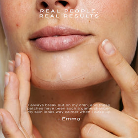 Vue Chin Patches overnight patch refines pores and reduces shine along the jawline.