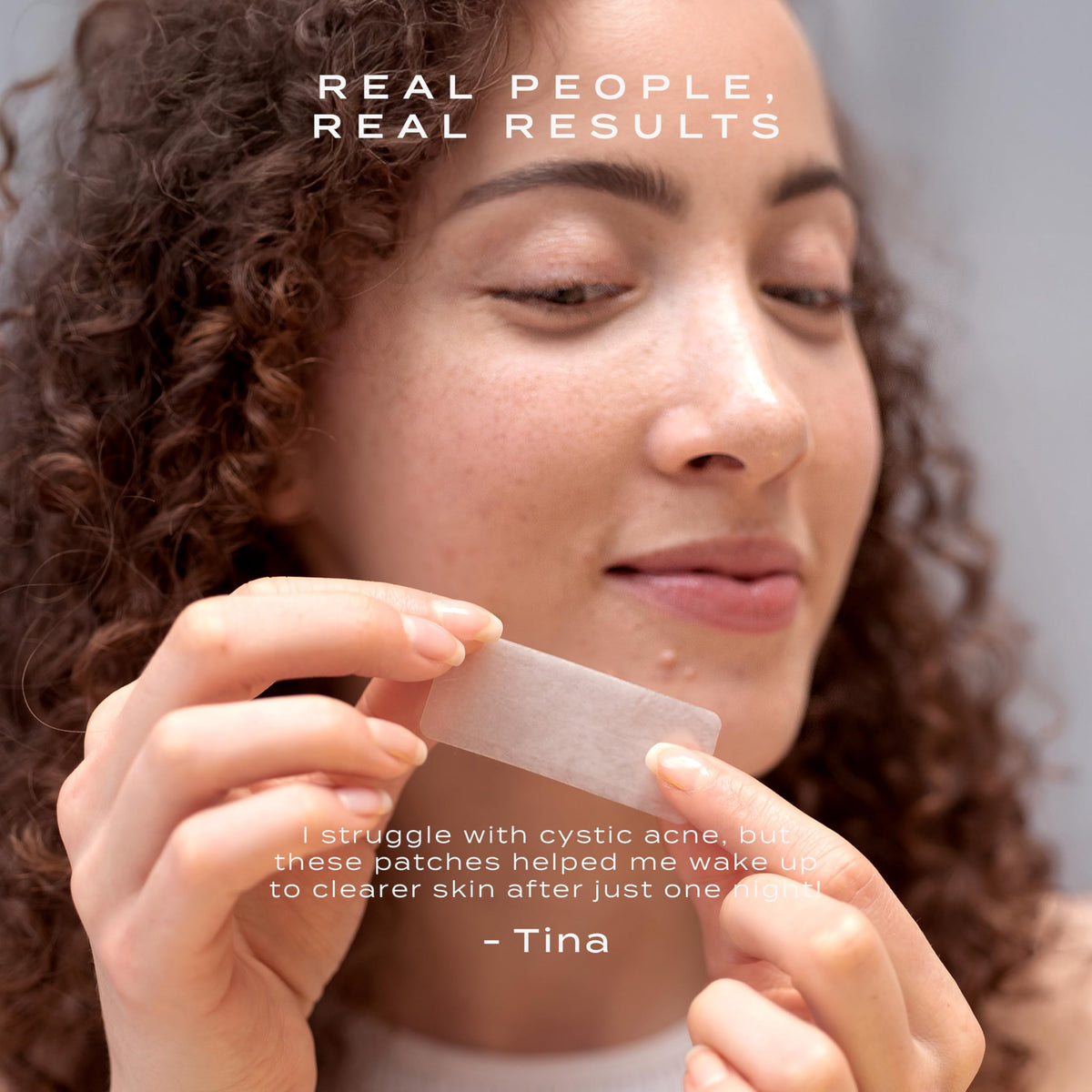 Vue Surface Clearing Patches hydrocolloid-technology absorbs impurities while safeguarding sensitive skin.