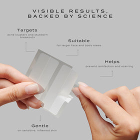 Vue Surface Clearing Patches large-back-body-coverage protect breakouts on back and chest.