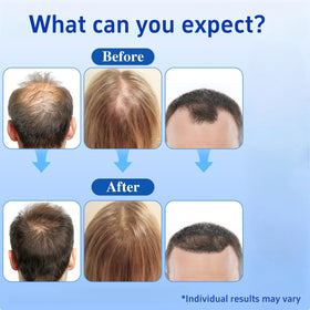 Wachinas anAgain and Redensyl roll-on nourishing roots during routine care