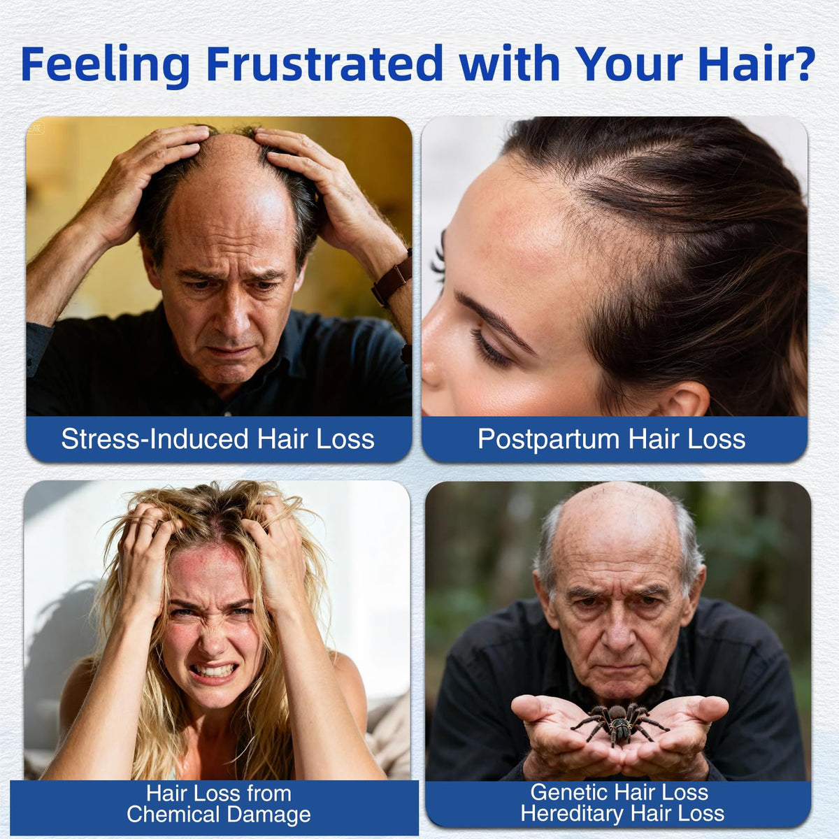 Wachinas biotin roll-on serum for everyday scalp vitality