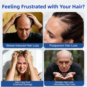 Wachinas biotin roll-on serum for everyday scalp vitality
