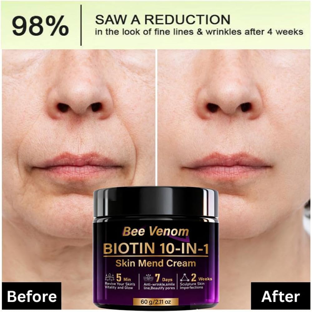 Water Ice Levin bee venom biotin cream jar closeup highlighting rich texture and luxurious application