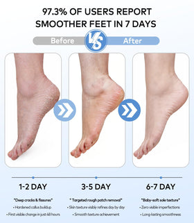 Whoalty natural pumice stone foot file reaches between toes for thorough exfoliation.
