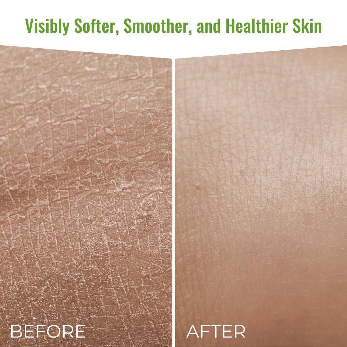 Aloe vera leaf beside Wild Naturals eczema wash for soothing care