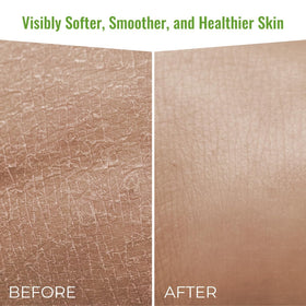 Aloe vera leaf beside Wild Naturals eczema wash for soothing care