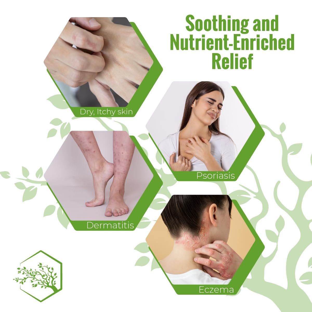 Wild Naturals lather provides gentle hydration for dry, itchy skin.