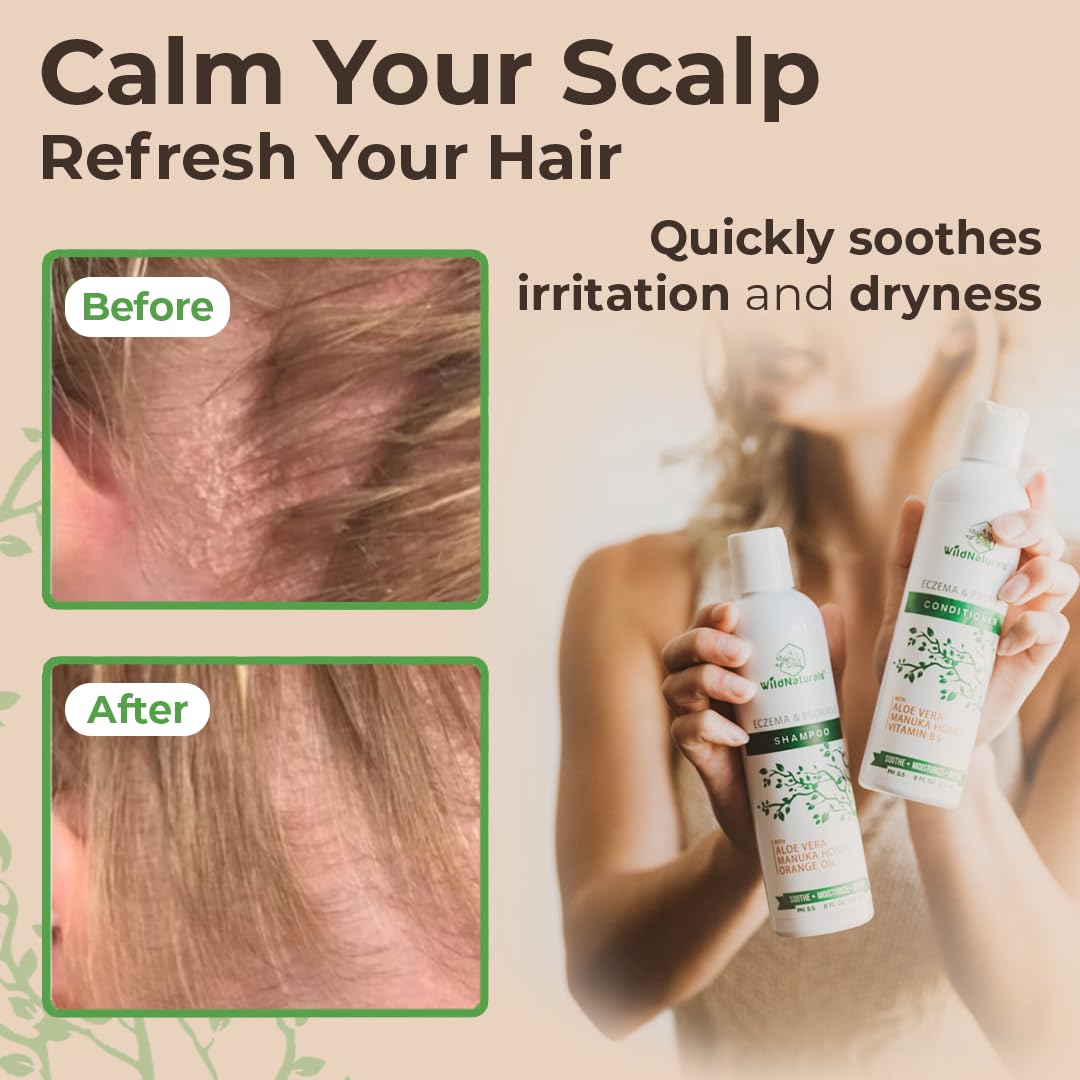 Wild Naturals ph-5-5 balanced formula for sensitive scalps.
