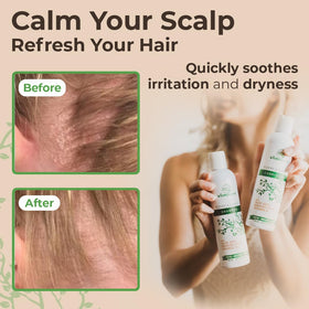 Wild Naturals ph-5-5 balanced formula for sensitive scalps.