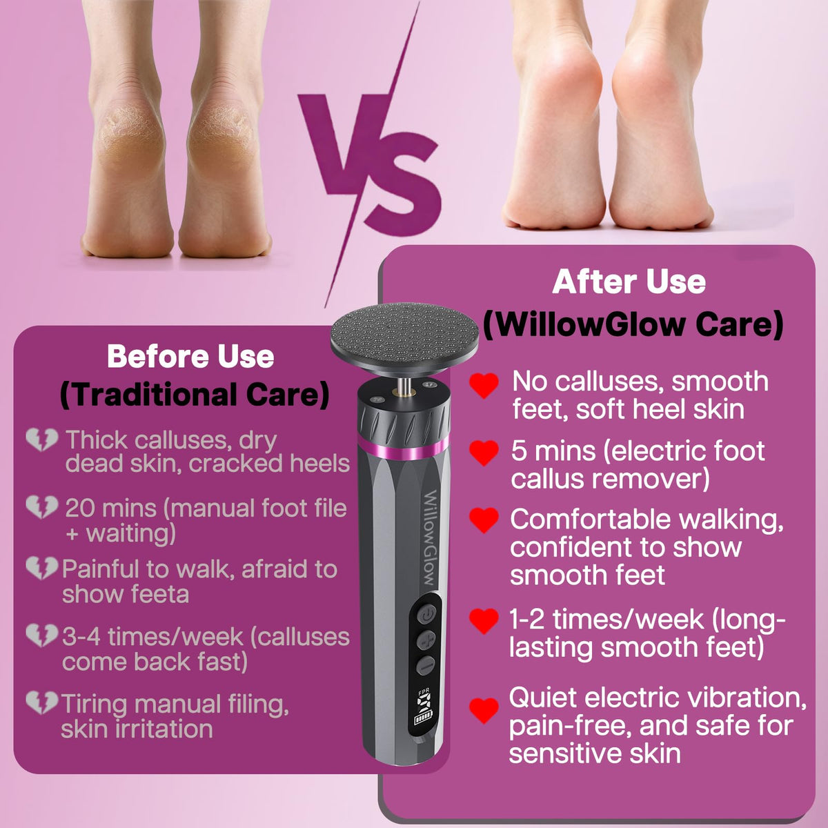 WillowGlow nine-speed settings tailor care for sensitive or stubborn areas.