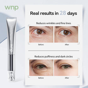 WNP Eye Cream uses peptides to help repair delicate under-eye skin.
