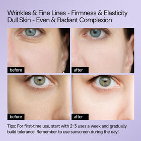 WNP Gentle Retinol Cream on face and neck designed for multi-area anti-aging.