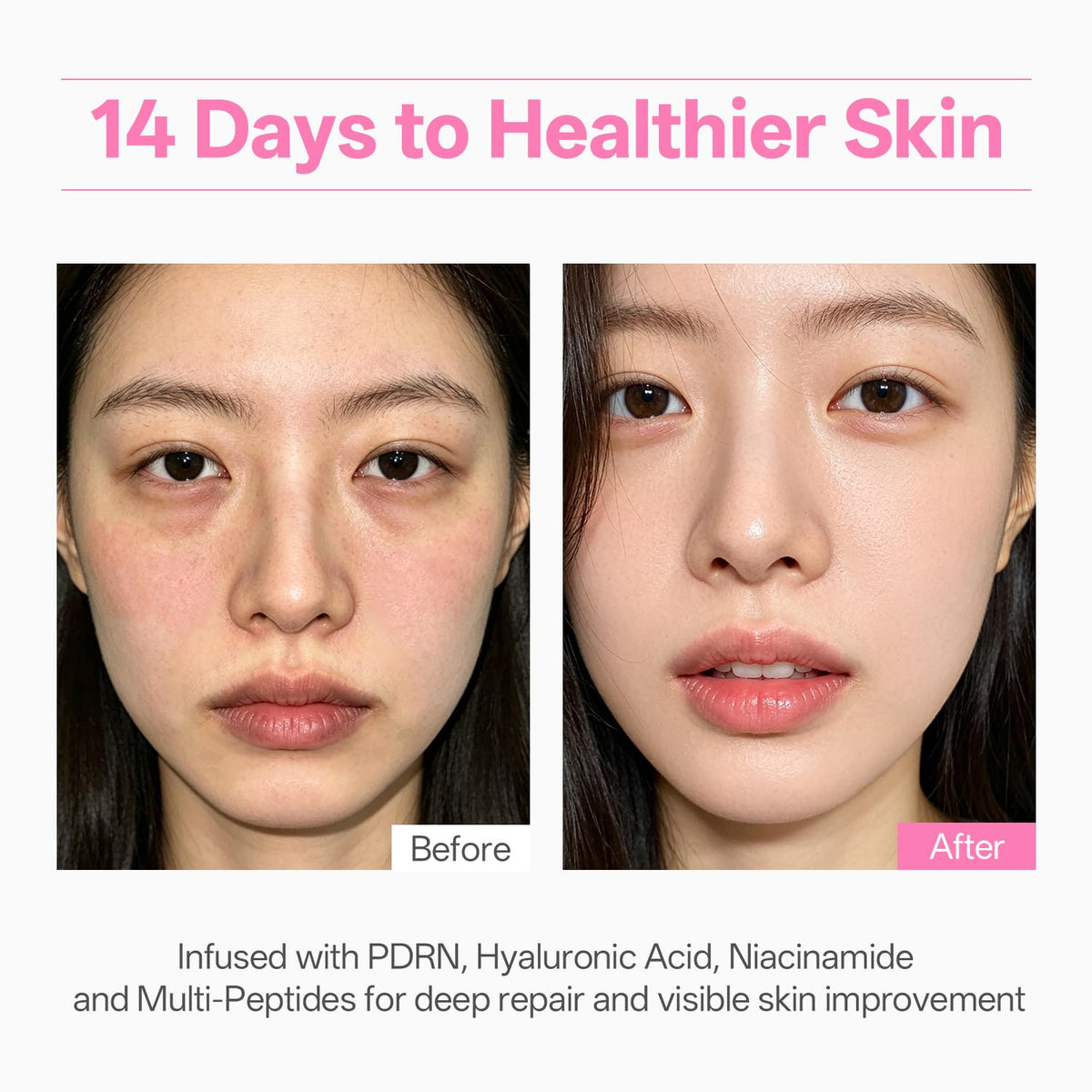 WNP Peptides firming skin for smoother appearance