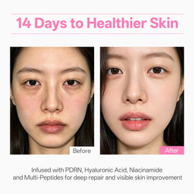 WNP Peptides firming skin for smoother appearance