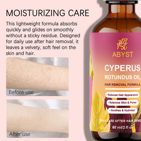 WOJJ Cyperus Rotundus Oil product display emphasizes natural care