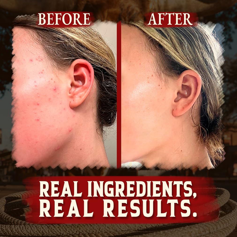 Wrath & Remedy balm soothing sensitive skin for eczema and rosacea-friendly care.