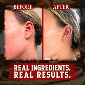 Wrath & Remedy balm soothing sensitive skin for eczema and rosacea-friendly care.