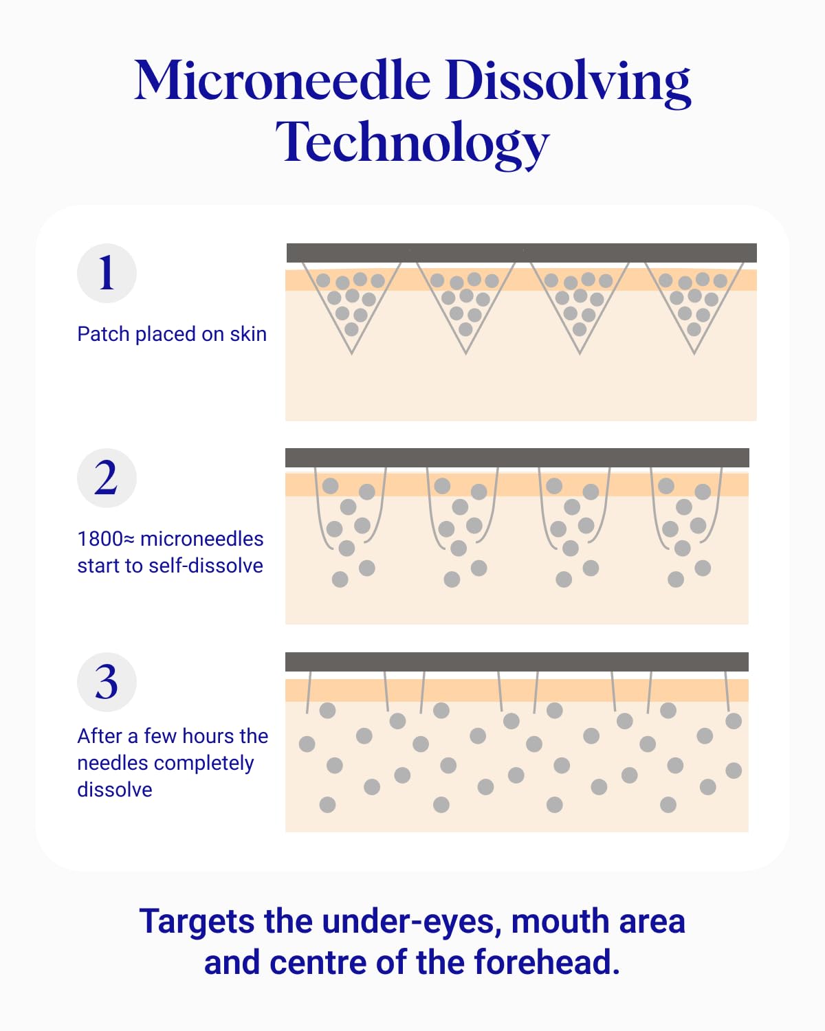 Wrinkles Schminkles microdart technology delivering actives deep into the skin