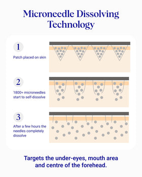 Wrinkles Schminkles microdart technology delivering actives deep into the skin