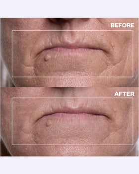 Wrinkles Schminkles Eye Patches hypoallergenic silicone hugging skin.
